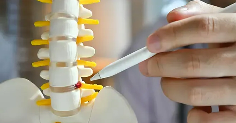 Disc+Injuries
