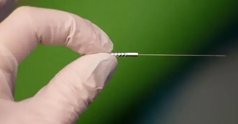 Dry Needling Service