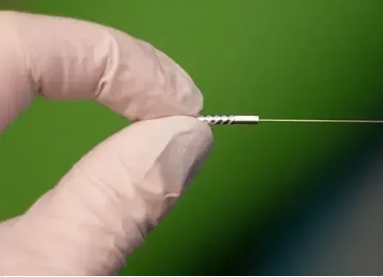 Dry Needling Service